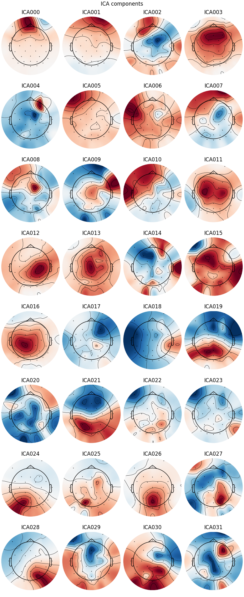 ICA components, ICA000, ICA001, ICA002, ICA003, ICA004, ICA005, ICA006, ICA007, ICA008, ICA009, ICA010, ICA011, ICA012, ICA013, ICA014, ICA015, ICA016, ICA017, ICA018, ICA019, ICA020, ICA021, ICA022, ICA023, ICA024, ICA025, ICA026, ICA027, ICA028, ICA029, ICA030, ICA031