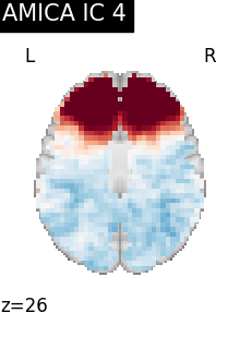 plot fmri